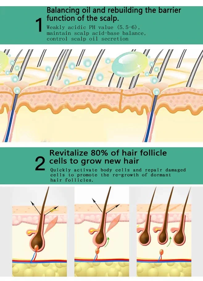 Manufautrure Wholesale for Hair Loss Treatment Styling Deep Moisturizing Hair Growth Spray